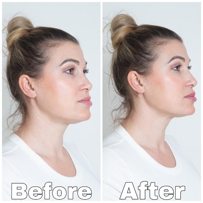 Side profile before and after photo of user